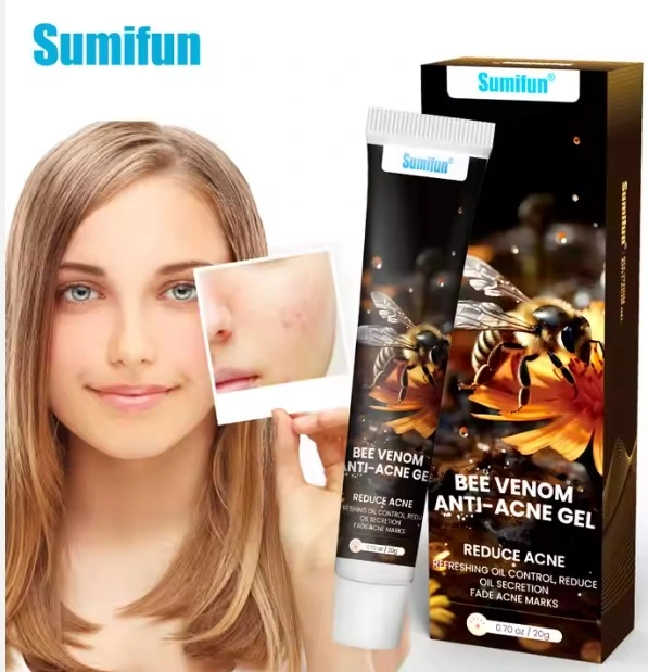 Acne Removing Ointment